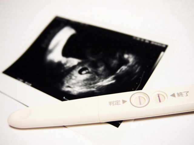 妊娠検査薬と超音波検査写真